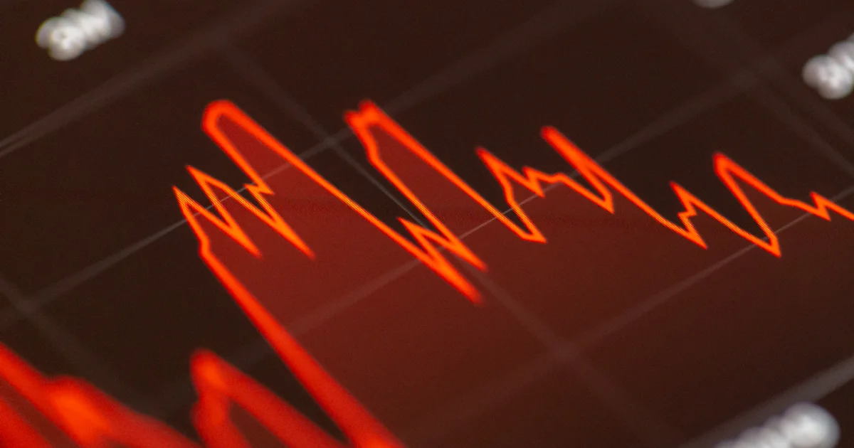 MSTY Dividend: How Much Does It Pay and Can You Live Off It?